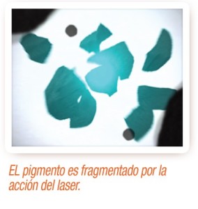 El pigmento se fragmenta por la acción del laser