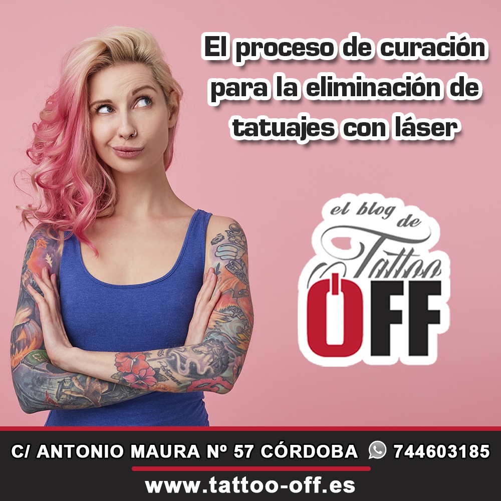 El proceso de curación para la eliminación de tatuajes con láser - TATTOO OFF