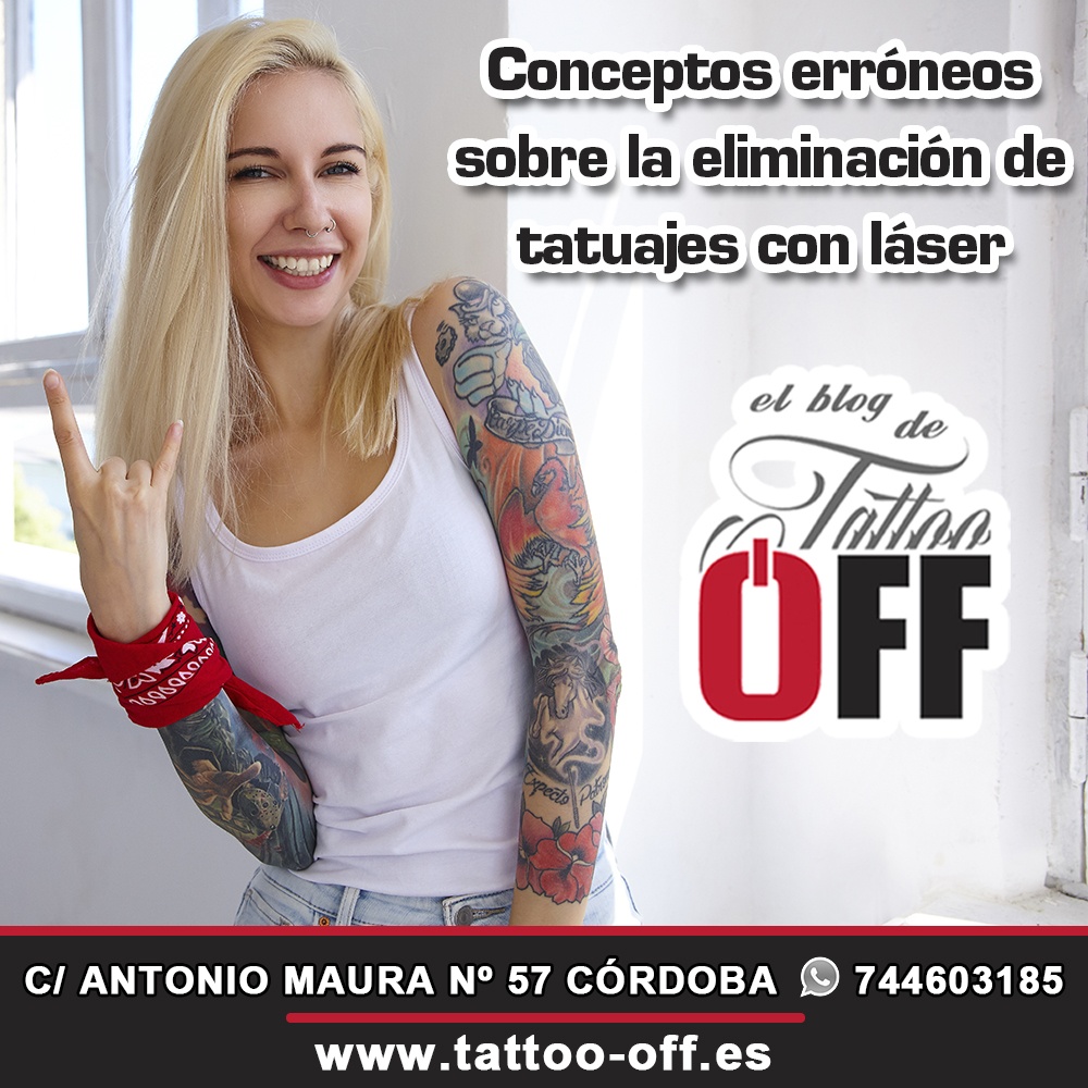 Conceptos erróneos sobre la eliminación de tatuajes con láser - TATTOO OFF